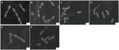 iTRAQ-based quantitative proteomic analysis of the antibacterial mechanism of silver nanoparticles against multidrug-resistant Streptococcus suis